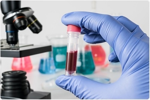 Microfluidic cancer treatment screen combined with flow cytometry