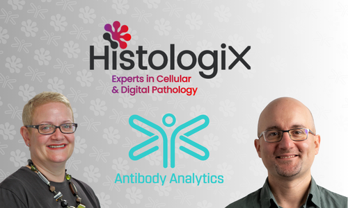 From Discovery to Clinical Testing: HistologiX and Antibody Analytics Forge Ground-breaking Alliance
